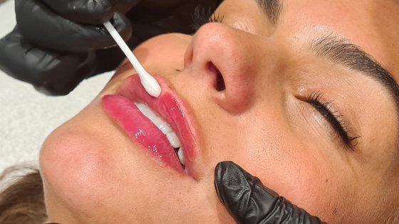 Collageen Lip Treatment Kuur